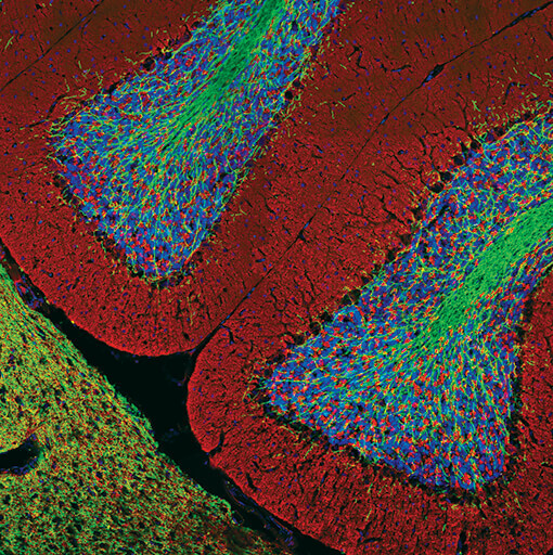 Myelin Basic Protein Immunofluorescence